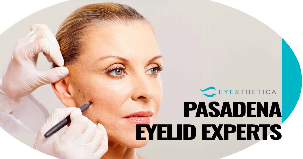 The Best Guide To Pasadena Oculofacial Procedures - Eyesthetica Eyelid ... thumbnail